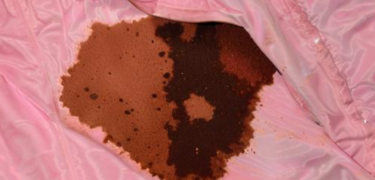 梦见身上沾屎预兆什么 梦见身上沾屎预兆什么