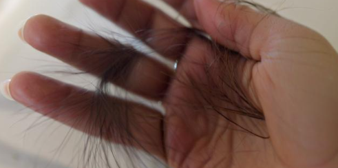 做梦梦见掉头发 做梦梦见掉头发