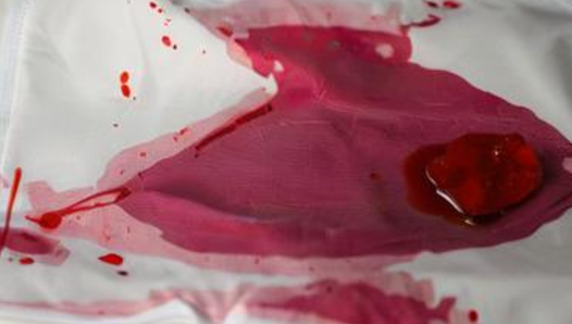 梦见自己来月经流血