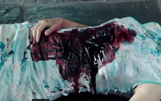 梦见血是什么意思 梦见血是什么意思