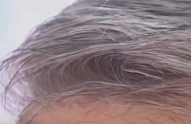 梦见自己长白头发 梦见自己长白头发