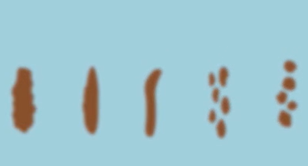 梦见大便 梦见大便