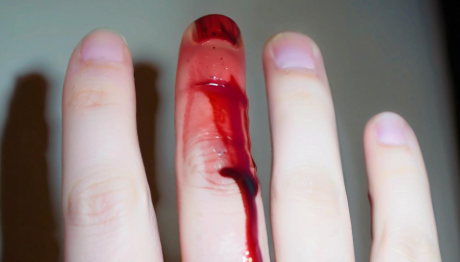 梦见流血 梦见流血