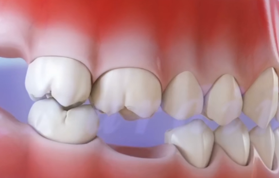 做梦梦见牙掉了