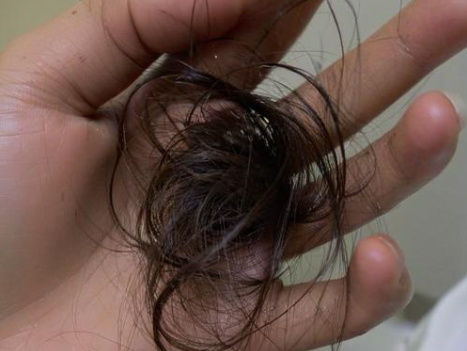 梦见自己掉头发 梦见自己掉头发