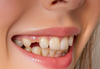 梦见牙掉了 梦见牙掉了